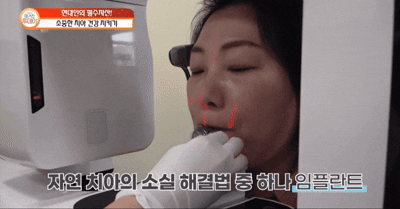 부평치과 임플란트 CT 3D 진단, 파노라마검사